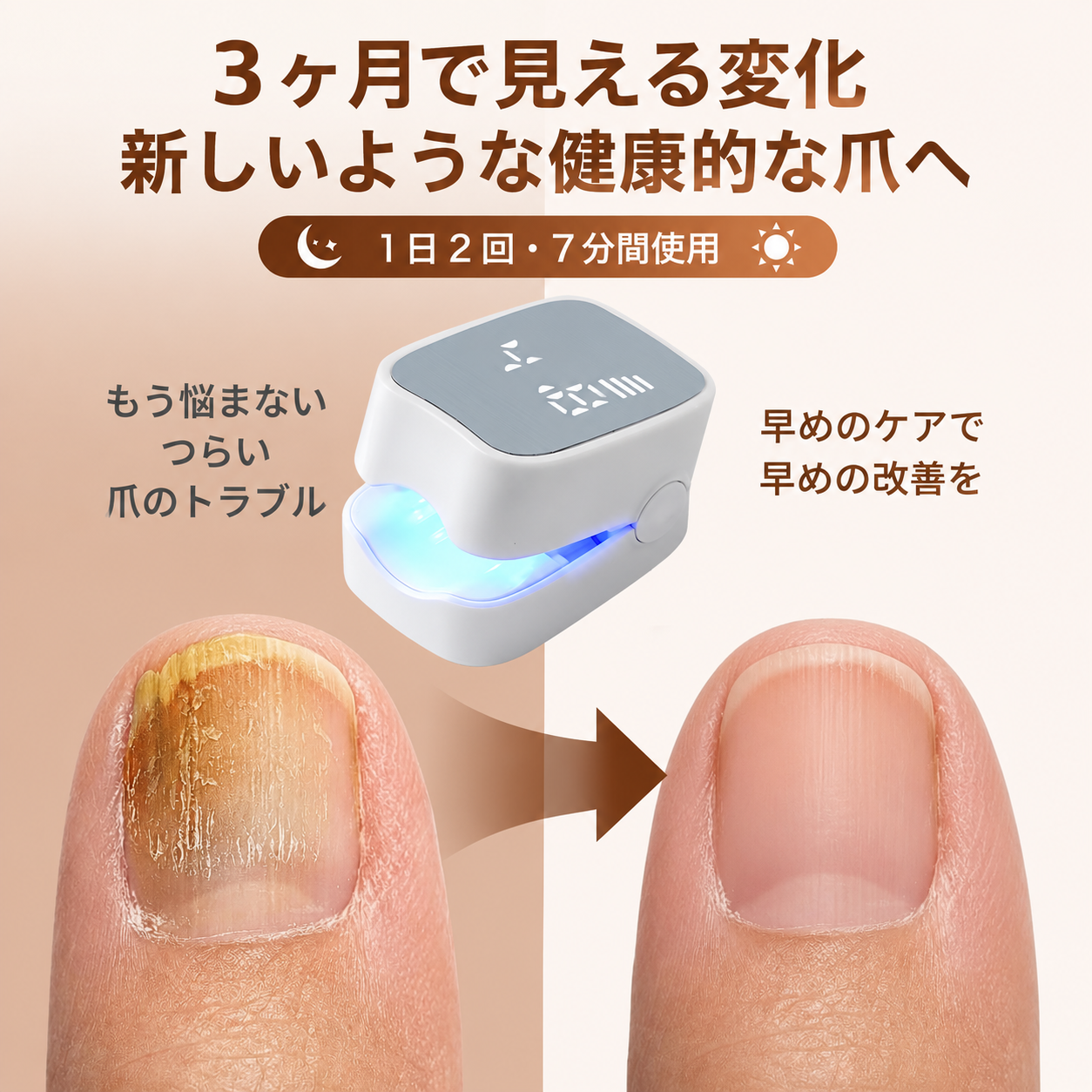 LEDライト搭載 フット＆フィンガー ケアライト｜USB充電式・コードレス コンパクト セルフケア